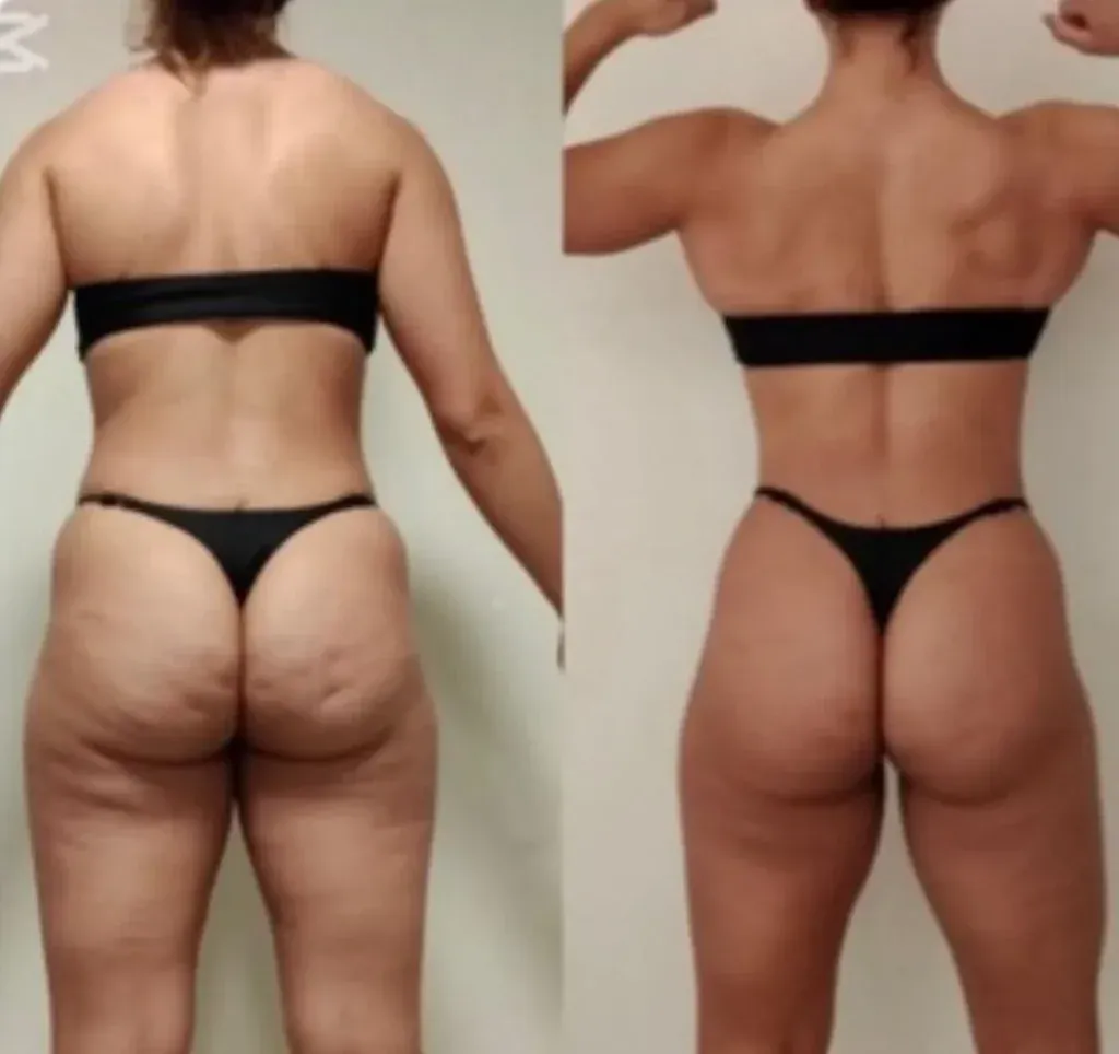 Transformación de Claudia