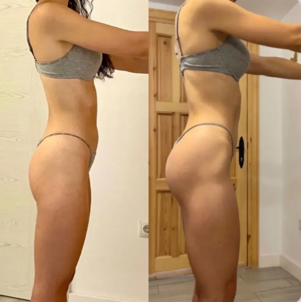 Transformación de Garazi