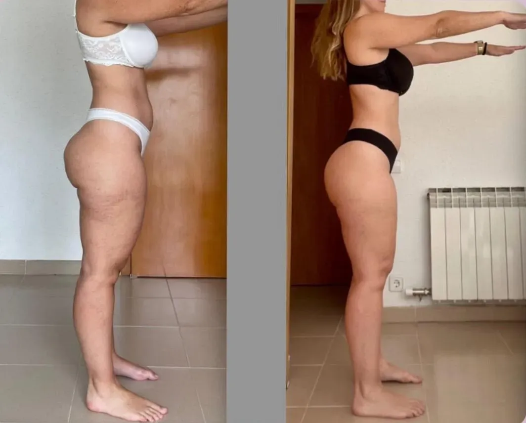 Transformación de Claudia (37 años)