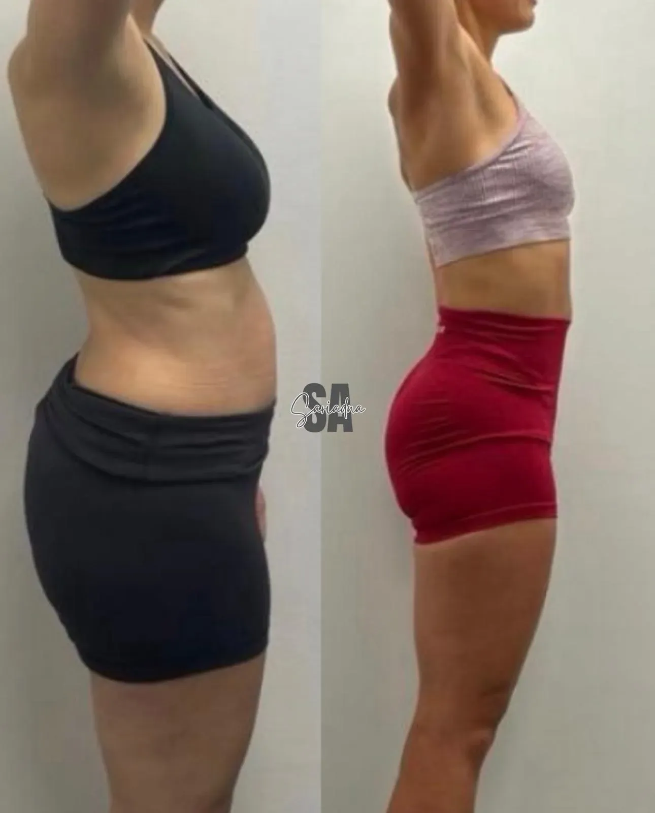 Transformación de Laura
